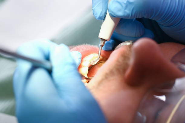 Dentist for Dental Trauma in WV