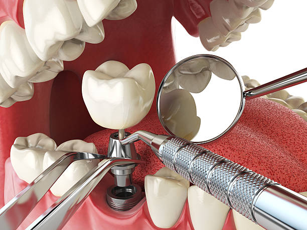 Best Knocked-Out Tooth Emergency  in Welch, WV